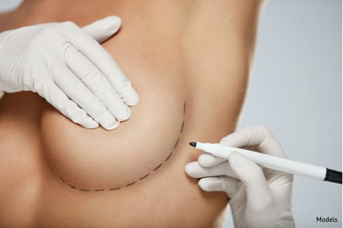 A woman at her breast lift consultation to learn how she will restore her perky breasts and how to recover properly.