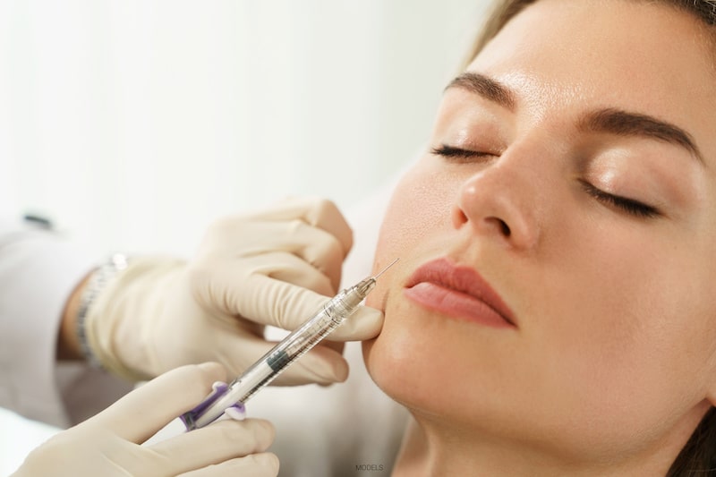 Woman getting a dermal filler injected into her nasolabial fold.