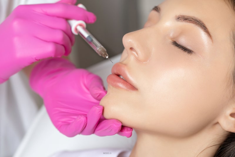 A woman receives a dermal filler to enhance her lips.