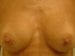 After Image