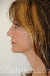 After Image